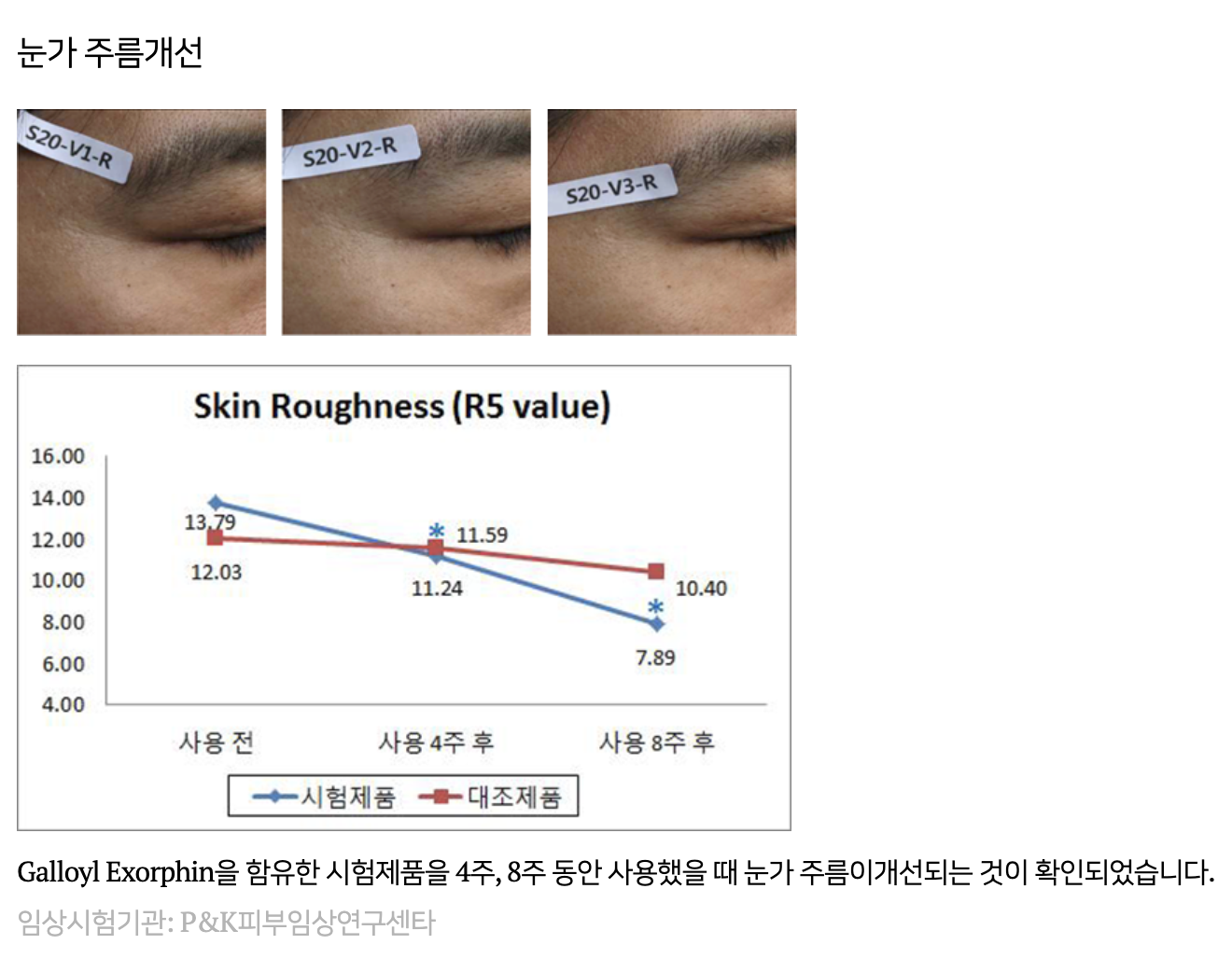 임상시험(내용)